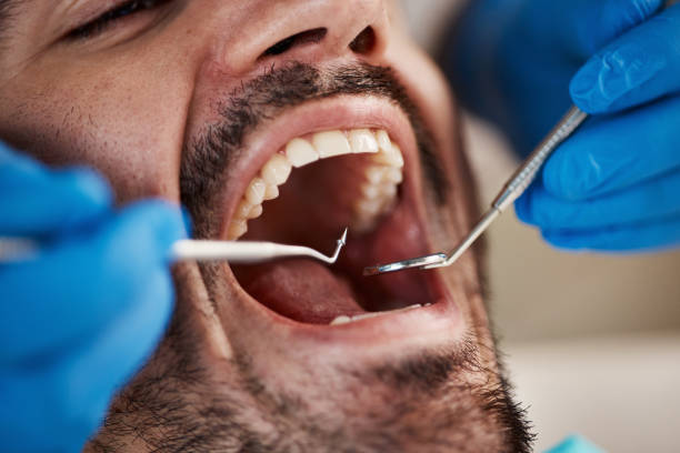 Best Pediatric Emergency Dentist in Mack, OH